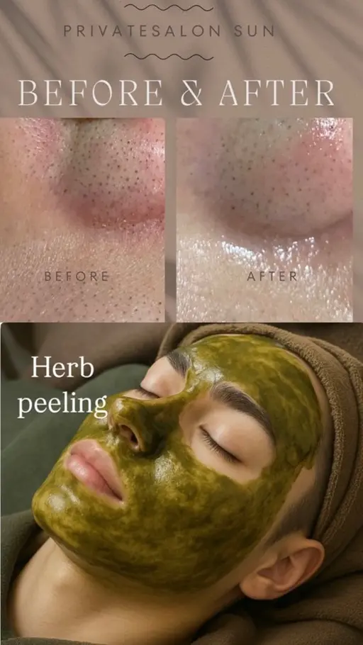 【12月限定🎄】 イチゴ鼻サヨウナラ！毛穴洗浄×ハーブピーリング40分 ［ニキビ、毛穴ケアで迷ったらコレ!］