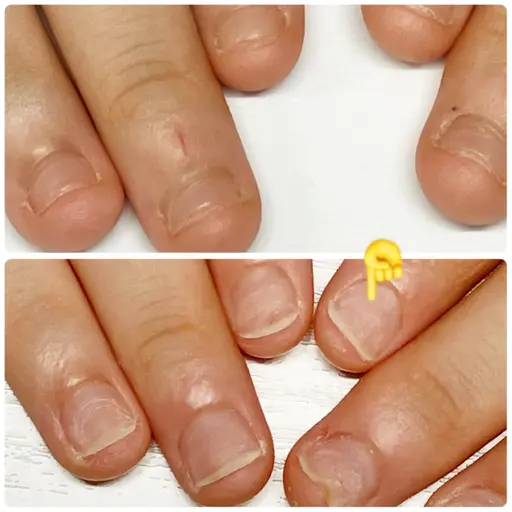深爪ケア施術✨自爪風仕上げ