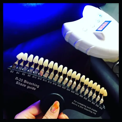 【なるべく早く歯を白くみせたい方へ☆】セルフホワイトニングで汚れ除去