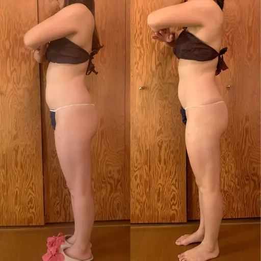 《モニター募集》【最新高周波カッピング】で気になる部位にアプローチ！！《1部位✖️6回》