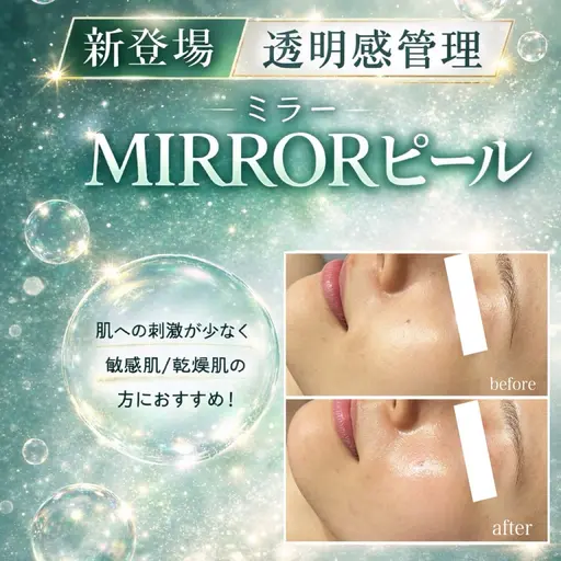 新メニュー☆透明肌管理【MIRRORピール】×プラズマ美容液導入