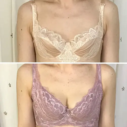 【新規限定】しぼんだバストケアコース