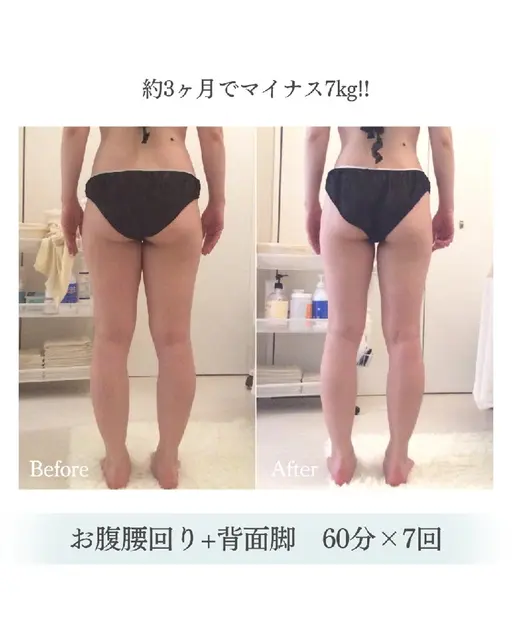 🌟ブライダルにも大人気💍短期集中痩身60分×6回✨痩せレシピ集付🎁