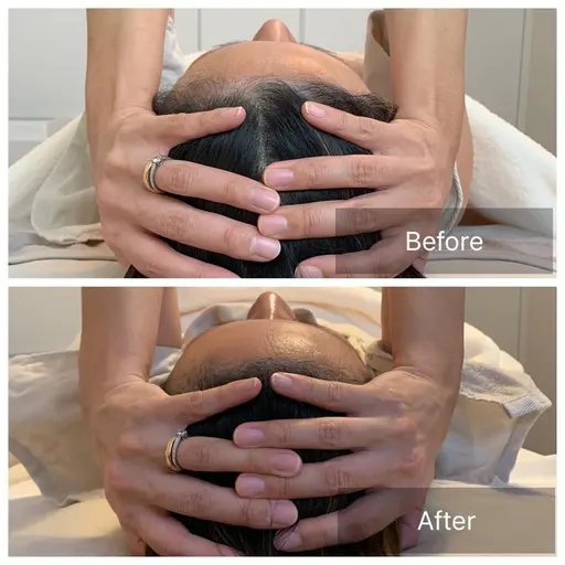 脳洗浄小顔調整オーダーメイド120分