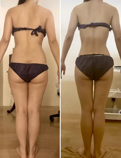 1年目セラピスト担当🍂全身セルライト＋むくみ＋肩こりケア🔥