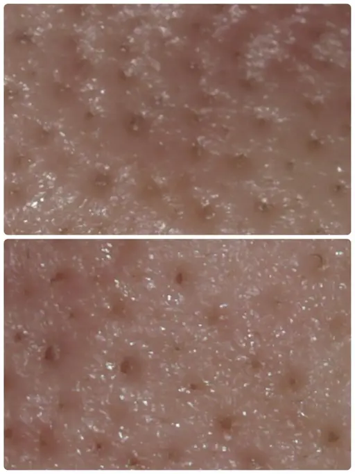 毛穴のつまりやザラつきが気になる方へ《超音波洗浄付フェイシャル​〜​デコルテケア》60分（メンズ可）