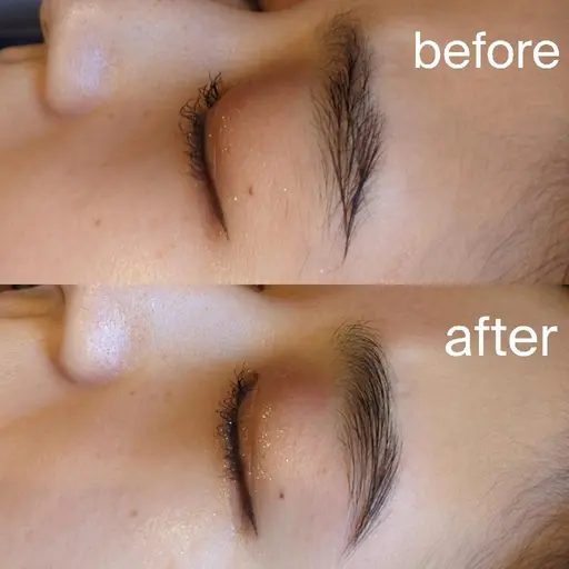 ハリウッドブロウリフト