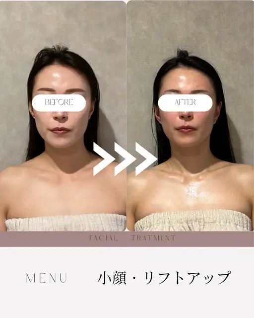 モニター募集🔴小顔になりたい方、ぜひ協力をお願いします