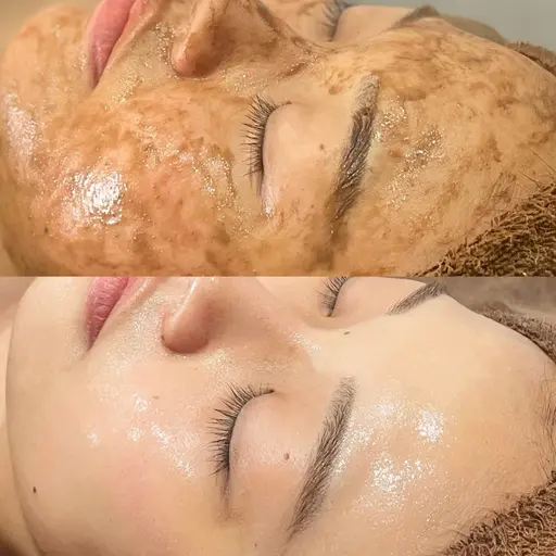 肌悩みに合わせオーダーメイドフェイシャルエステ★HPB口コミ4.9★（155件）本格肌質改善サロン💎毛穴/ニキビ/艶肌