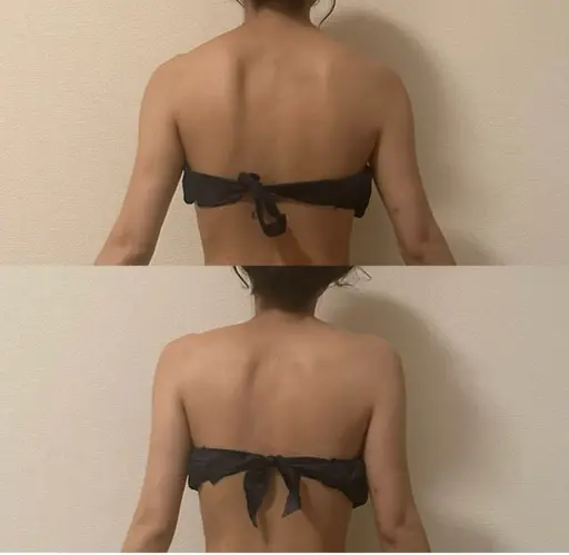 🆕体質改善サーモケア✨90分✨インディバ最新機種同等ハイスペック深部加熱マシーン