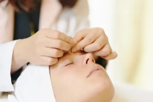 ⭐人気NO.2⭐美容鍼✩.*˚