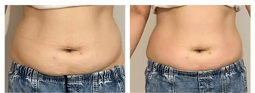 【毎月2名様‼️】本気で痩せたい方へ!結果重視!モニター価格にてプランが選べます