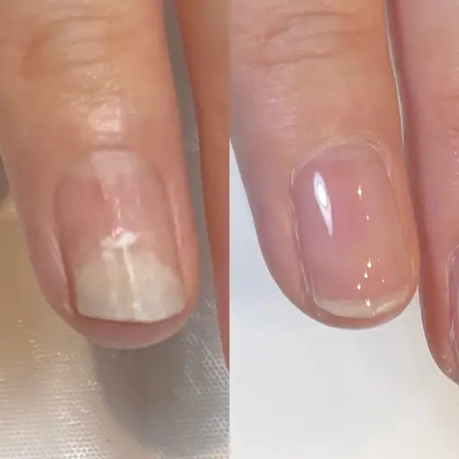 オーナー津蔵とスタッフが担当する『ハンドの剥離解消メニュー』 無料　※必ず補足説明をご確認ください。