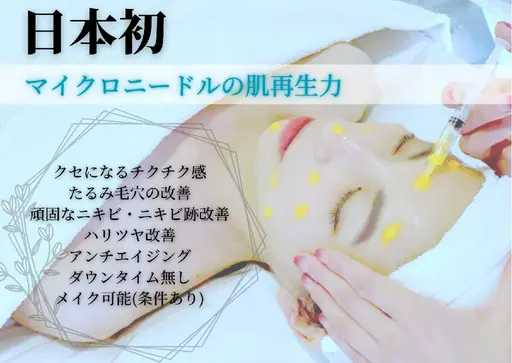 🔴日本初🔴【頑固なニキビ・ニキビ跡・老化肌にお勧め】マイクロニードルピーリング🪡