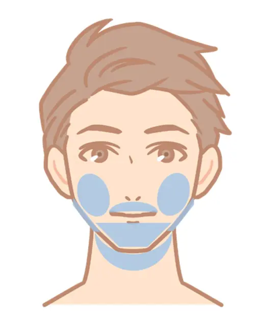 ★当店人気No.１★【顔ヒゲ】脱毛