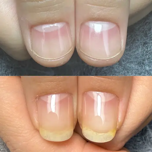 本気で変わりたい人向け✨️深爪/自爪育成⇒カウンセリング付き【お悩み爪の原因から解説して自分でキープしていけるように*】