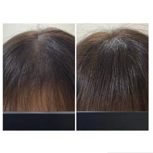 【増毛エクステ】800本✨️  自然にバレずにボリュームUP❗️ ミニモ限定価格 20%OFF🕊‪