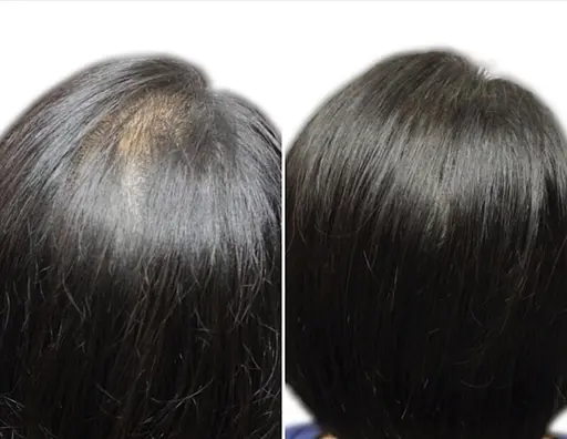 増毛エクステ500本(カウンセリング込)