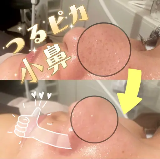 毛穴角質除去クレンジング！！【まつ毛　眉毛のメニューに追加も可能です！その場合初回は1500円になります！】