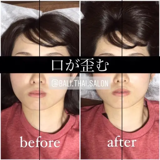 minimo特別❣️あご＋頭蓋骨小顔矯正 💆🏻‍♀️ 顔の歪み 全部込み❤️ お試しパーフェクトコース