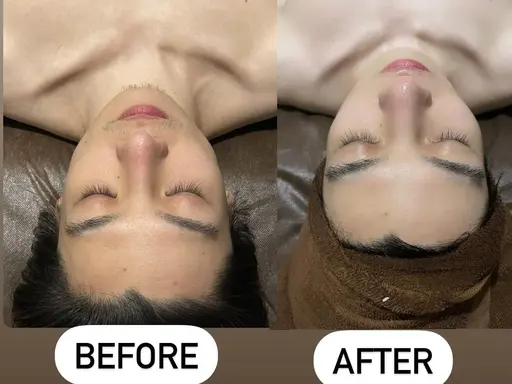 ✨メンズ✨ フェイシャルワックス  産毛除去¥8800