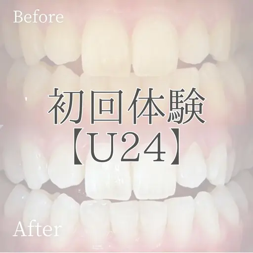 【ミニモ学割ホワイトニング🦷✨】おためし¥2,000✨2回目以降もコスパがいいからホワイトニング始めやすいです😊