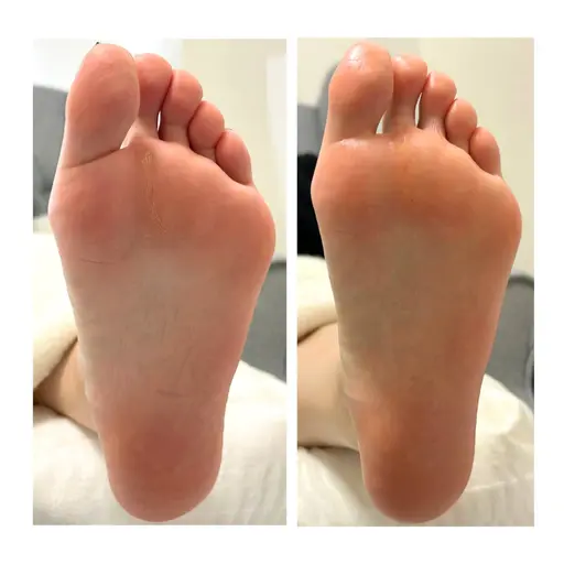 ［フットケア］ベーシックコース