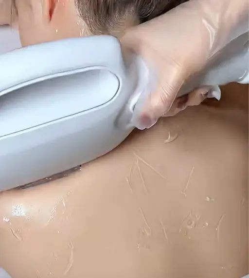 【新規導入美肌光脱毛】4月限定全身脱毛(顔VIOなし)一回