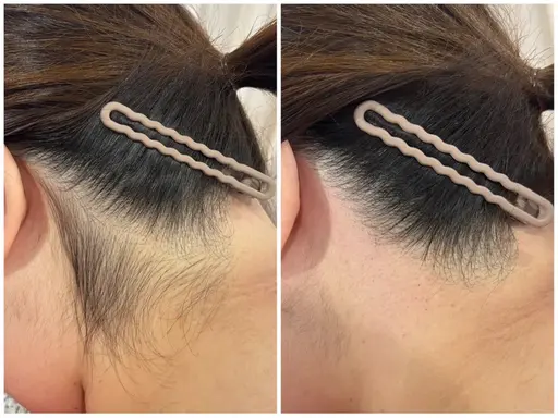 うなじWAX(5名様限定)