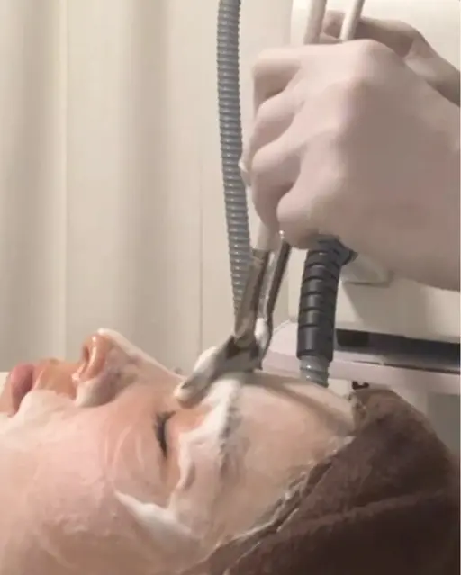 肌管理フェイシャル（セラピール）