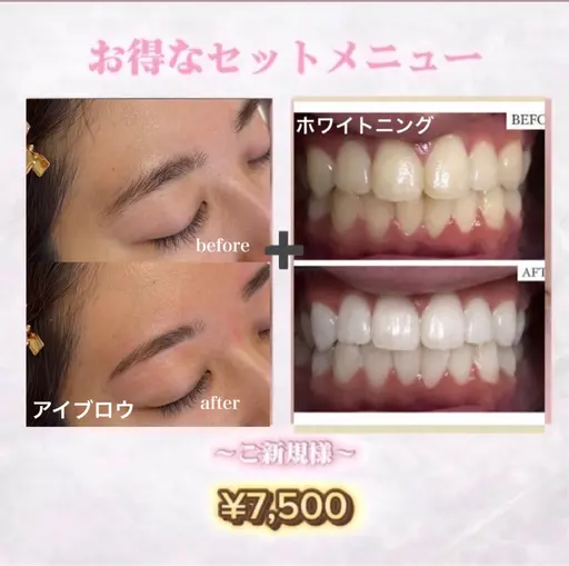 【🪞時短同時垢抜け 眉×歯set】一石二鳥の最強セット🕊️