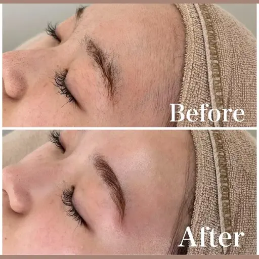 【移転記念】お顔シェービング+フェイシャル+リンパ✨究極のむきたまご肌コース♡