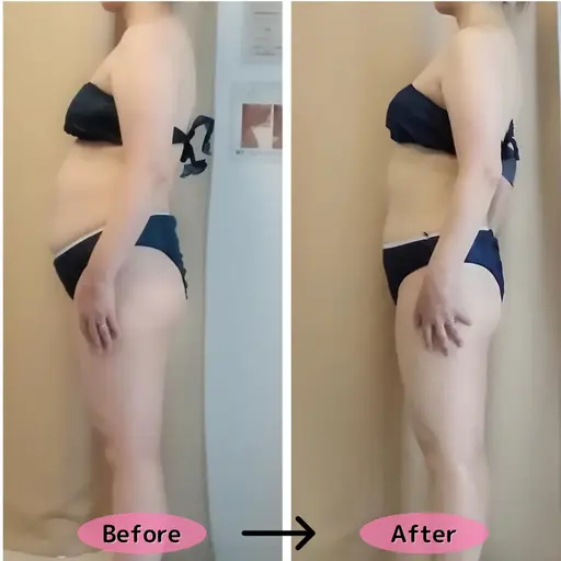 【人気No.1】本気痩せ🔥全身痩身90分▶23,100円→8,680円✨