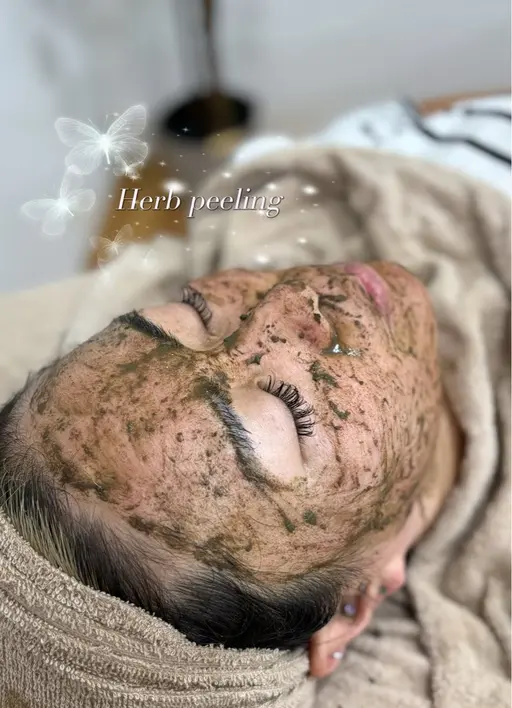 【新規open】ハーブピーリング(剥離あり)［クレンジング+洗顔+鎮静化粧水+クリーム付き］