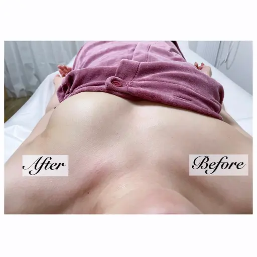 【18日(日)限定1名】バストアップ　オーダーメイド施術80分　¥18500→¥5000