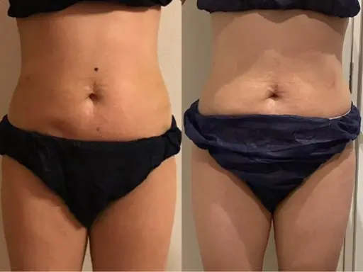 【人気No.1】〈睡眠の質向上/サイズダウン〉全身リンパコース