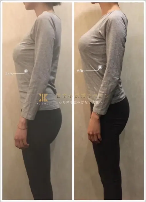 【VIPメニュー】カイロ骨格矯正&肋骨・骨盤締め&小顔矯正150分