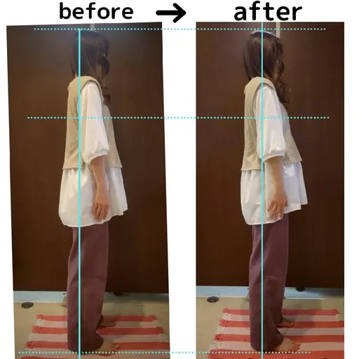 【男性女性】キネセラ＋小顔マッサージ(顔首頭)