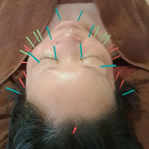 モニター特別価格📣当店人気No.1👑背中から緩めて引き上げる✨背中マッサージ+小顔リンパ&小顔リフト美容鍼+ヘッド付