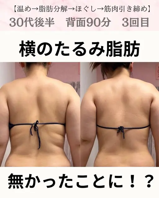 3月限定🌸背中・二の腕集中！上半身たるみ引き締めケア90分¥17,800→12,800