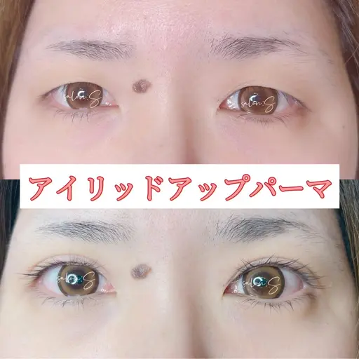 【仙台初】アイリッドアップパーマ（瞼引き上げマツパ）