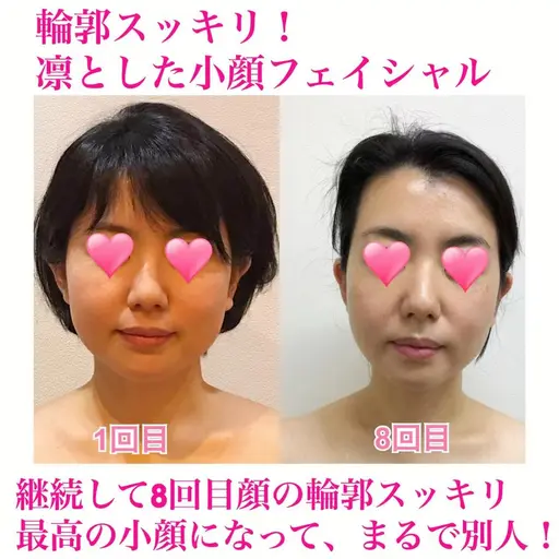 120分 凛とした小顔&若見え肌 ★高リピータ率