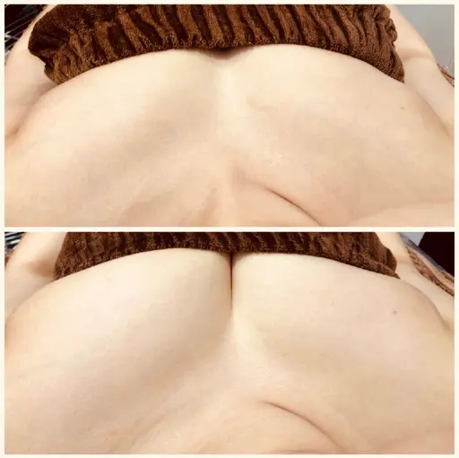 【まずはお試し】痛くない光豊胸、フラッシュバスト300ショットで本気の美乳ケア❤都内唯一のバスト専用機導入★