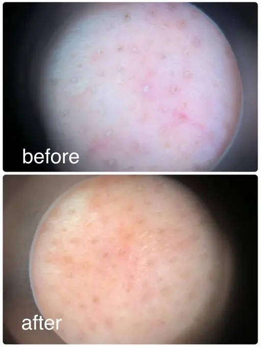 フェイシャル首肩ケアコース