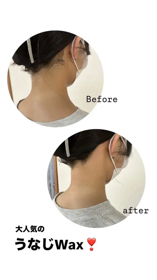 人気の脱毛メニュー🥹🤎【うなじwax✖️痛くない光脱毛💆‍♀️】通常¥5,500▶︎▶︎¥3,500🌸
