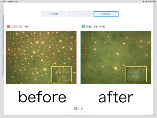 【迷う人はこれ】オーヴル毛穴リポア(汚れ1回で綺麗に取りたい人◎)スチーマー・毛穴カメラ診断付き