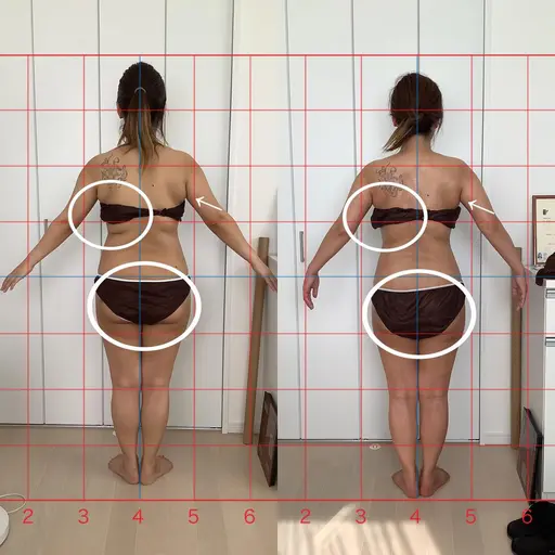 【新年お年玉キャンペーン】本格全身痩身エステ 30%OFF❣️