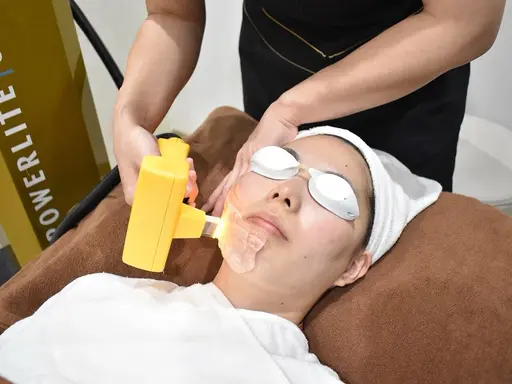 《都度払い》都内最安価格！シミ・たるみ撃退！海外医療規格機パワーライト光フェイシャル💡