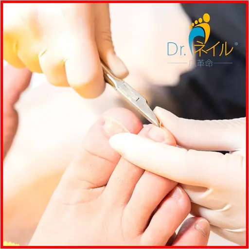 【Quickフットケア】クイック足爪カット