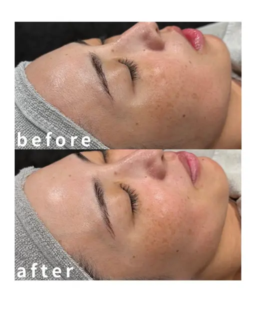 【レギュラーシェービング】クレンジング＋顔シェービング（眉込み）＋プレミアムケアマスク